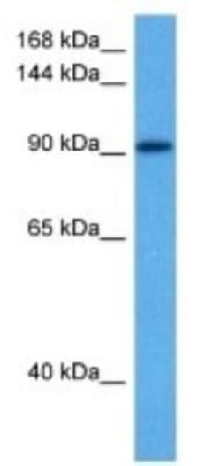 ARVCF Rabbit anti-Human, Polyclonal, Novus Biologicals 100 &mu;g | Buy Online | Novus Biologicals | Fisher Scientific